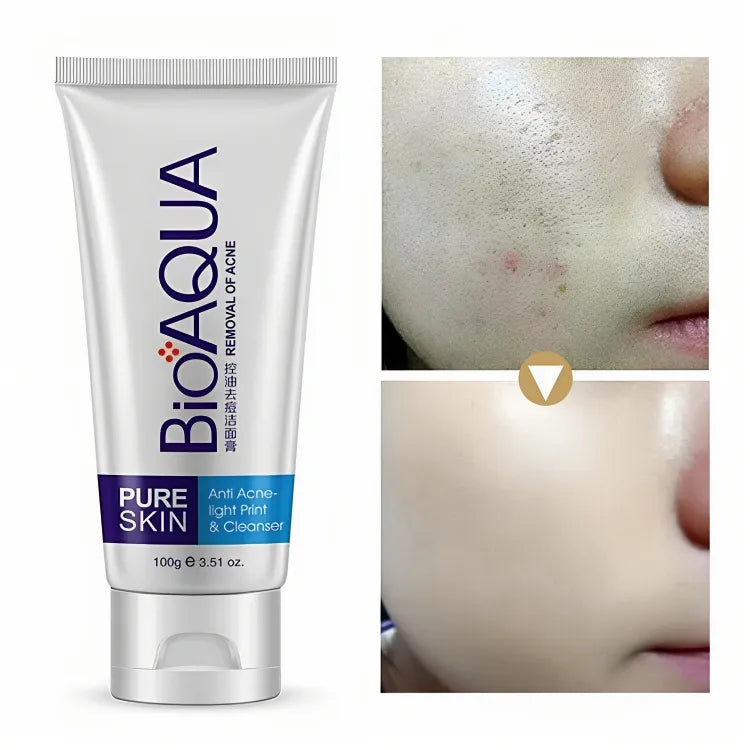 BIOAQUA Skin Care Removal of Acne Cleanser